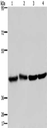 Gel: 6%SDS-PAGE, Lysate: 40 μg, Lane 1-4: Human fetal liver tissue, Human brain tissue, 293T cells, Hela cells, Primary antibody: DRG1 Antibody(DRG1 Antibody) at dilution 1/350, Secondary antibody: Goat anti rabbit IgG at 1/8000 dilution, Exposure time: 20 secondsRabbit anti-Human DRG1 Polyclonal Antibody