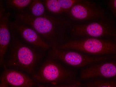 Immunofluorescence staining of methanol-fixed MCF cells using Estrogen Receptor-a(Ab-118) Antibody.Rabbit anti-Human ESR1 Polyclonal Antibody