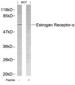 Western blot analysis of extracts from MCF cells using Estrogen Receptor-a(Ab-118) Antibody and the same antibody preincubated with blocking peptide.Rabbit anti-Human ESR1 Polyclonal Antibody