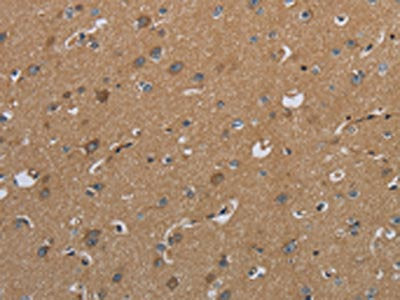 The image on the left is immunohistochemistry of paraffin-embedded Human brain  tissue using CSH1 Antibody(CSH1 Antibody) at dilution 1/50, on the right is treated with fusion protein. (Original magnification: ×200)Rabbit anti-Human CSH1 Polyclonal Antibody