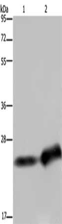 Gel: 10%SDS-PAGE, Lysate: 40 μg, Lane 1-2: Human breast infiltrative duct tissue, Human placenta tissue, Primary antibody: CSH1 Antibody(CSH1 Antibody) at dilution 1/300, Secondary antibody: Goat anti rabbit IgG at 1/8000 dilution, Exposure time: 10 secondsRabbit anti-Human CSH1 Polyclonal Antibody