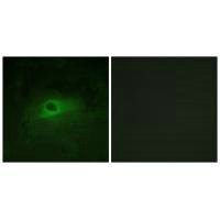 Immunofluorescence analysis of HeLa cells, using CSFR (Ab-809) antibody.Rabbit anti-Human CSF1R Polyclonal Antibody