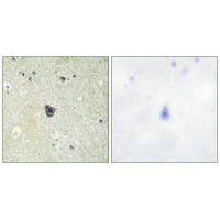 Immunohistochemistry analysis of paraffin-embedded human brain tissue using CSFR (Ab-809) antibody.Rabbit anti-Human CSF1R Polyclonal Antibody
