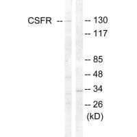 Western blot analysis of extracts from HT-29 cells, using CSFR (Ab-809) antibody.Rabbit anti-Human CSF1R Polyclonal Antibody