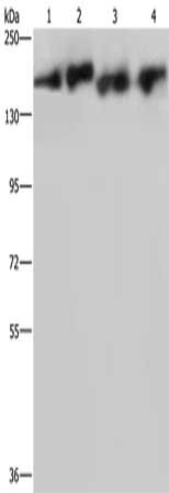 Gel: 6%SDS-PAGE, Lysate: 40 μg, Lane 1-4: PC3 cells, A431 cells, mouse lung tissue, Hela cells, Primary antibody: PLCB3 Antibody(PLCB3 Antibody) at dilution 1/200, Secondary antibody: Goat anti rabbit IgG at 1/8000 dilution, Exposure time: 3 minutesRabbit anti-Human PLCB3 Polyclonal Antibody