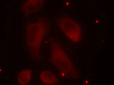 Immunofluorescence staining of methanol-fixed Hela cells using LIMK1(Phospho-Thr508) Antibody.