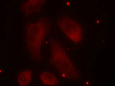 Immunofluorescence staining of methanol-fixed Hela cells using LIMK1(Phospho-Thr508) Antibody.