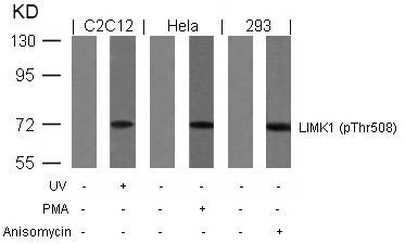 Western blot analysis of extracts from UV-treated C2C12, PMA-treated Hela and anisomycin-treated 293 cells using LIMK1(Phospho-Thr508) Antibody.