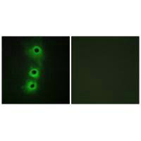Immunofluorescence analysis of COS7 cells, using CDH8 antibody.Rabbit anti-Human CDH8 Polyclonal Antibody