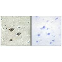 Immunohistochemistry analysis of paraffin-embedded human brain tissue using CDH8 antibody.Rabbit anti-Human CDH8 Polyclonal Antibody