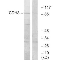 Western blot analysis of extracts from RAW264.7 cells, using CDH8 antibody.Rabbit anti-Human CDH8 Polyclonal Antibody
