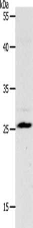 Gel: 10%SDS-PAGE, Lysate: 80 μg, Lane: Mouse liver tissue, Primary antibody: NQO2 Antibody(NQO2 Antibody) at dilution 1/1200, Secondary antibody: Goat anti rabbit IgG at 1/8000 dilution, Exposure time: 45 secondsRabbit anti-Human NQO2 Polyclonal Antibody