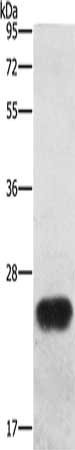 Gel: 10%SDS-PAGE, Lysate: 40 μg, Lane: Mouse spleen tissue, Primary antibody: BCAS4 Antibody(BCAS4 Antibody) at dilution 1/1200, Secondary antibody: Goat anti rabbit IgG at 1/8000 dilution, Exposure time: 1 second