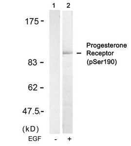 Western blot analysis of extracts from SKOV3 cells untreated(lane 1) or treated with EGF(lane 2) using Progesterone Receptor(Phospho-Ser190) Antibody.Rabbit anti-Human PGR Polyclonal Antibody