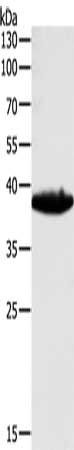 Gel: 10%SDS-PAGE, Lysate: 40 μg, Lane: Mouse heart tissue, Primary antibody: TGFB1 Antibody(TGFB1 Antibody) at dilution 1/450, Secondary antibody: Goat anti rabbit IgG at 1/8000 dilution, Exposure time: 20 secondsRabbit anti-Human TGFB1 Polyclonal Antibody