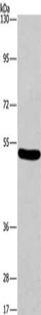 Gel: 6%SDS-PAGE, Lysate: 40 μg, Lane: Mouse brain tissue, Primary antibody: ARC Antibody(ARC Antibody) at dilution 1/597, Secondary antibody: Goat anti rabbit IgG at 1/8000 dilution, Exposure time: 1 minuteRabbit anti-Human ARC Polyclonal Antibody