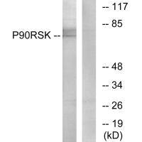Western blot analysis of extracts from 3T3 cells, treated with PMA (125ng/ml, 30mins), using p90 RSK (Ab-573) antibody.Rabbit anti-Human RPS6KA1 Polyclonal Antibody
