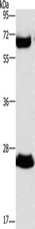 Gel: 10%SDS-PAGE, Lysate: 40 μg, Lane: Human fetal liver tissue, Primary antibody: GGT1 Antibody(GGT1 Antibody) at dilution 1/300, Secondary antibody: Goat anti rabbit IgG at 1/8000 dilution, Exposure time: 40 secondsRabbit anti-Human GGT1 Polyclonal Antibody