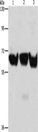 Gel: 8%SDS-PAGE, Lysate: 80 μg, Lane 1-3: 293T cells, PC3 cells, hela cells, Primary antibody: ADRA1B Antibody(ADRA1B Antibody) at dilution 1/500, Secondary antibody: Goat anti rabbit IgG at 1/8000 dilution, Exposure time: 2 minutesRabbit anti-Human ADRA1B Polyclonal Antibody