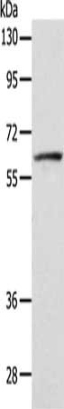 Gel: 8%SDS-PAGE, Lysate: 40 μg, Lane: Hela cells, Primary antibody: VANGL1 Antibody(VANGL1 Antibody) at dilution 1/250, Secondary antibody: Goat anti rabbit IgG at 1/8000 dilution, Exposure time: 5 secondsRabbit anti-Human VANGL1 Polyclonal Antibody