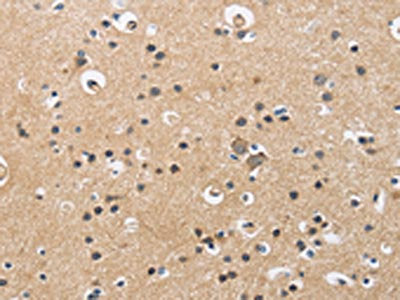 The image is immunohistochemistry of paraffin-embedded Human brain tissue using the antibody Antibody) at dilution 1/60. (Original magnification: ×200)Rabbit anti-Human CKMT2 Polyclonal Antibody
