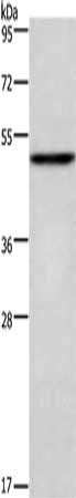 Gel: 8%SDS-PAGE, Lysate: 40 μg, Lane: Mouse heart tissue, Primary antibody: CKMT2 Antibody(CKMT2 Antibody) at dilution 1/700, Secondary antibody: Goat anti rabbit IgG at 1/8000 dilution, Exposure time: 1 minuteRabbit anti-Human CKMT2 Polyclonal Antibody
