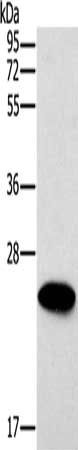Gel: 10%SDS-PAGE, Lysate: 40 μg, Lane: Mouse heart tissue, Primary antibody: ERAS Antibody(ERAS Antibody) at dilution 1/500, Secondary antibody: Goat anti rabbit IgG at 1/8000 dilution, Exposure time: 20 secondsRabbit anti-Human ERAS Polyclonal Antibody