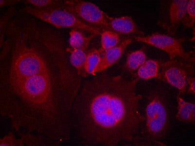 Immunofluorescence staining of methanol-fixed Hela cells using STAT3(Phospho-Ser727) Antibody.Rabbit anti-Human STAT3 Polyclonal Antibody