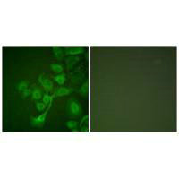 Immunofluorescence analysis of A549 cells, using TIMP2 antibody.Rabbit anti-Human TIMP2 Polyclonal Antibody
