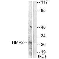 Western blot analysis of extracts from A549 cells, using TIMP2 antibody.Rabbit anti-Human TIMP2 Polyclonal Antibody