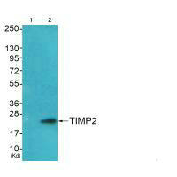 Western blot analysis of extracts from HepG2  cells (Lane 2), using TIMP2 antiobdy. The lane on the left is treated with systhesized peptide.Rabbit anti-Human TIMP2 Polyclonal Antibody