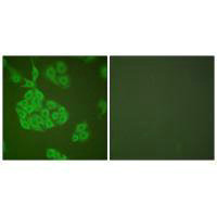 Immunofluorescence analysis of A549 cells, using MMP-11 antibody.