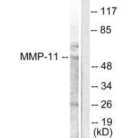 Western blot analysis of extracts from A549 cells, using MMP-11 antibody.