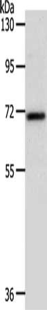 Gel: 10%SDS-PAGE, Lysate: 40 μg, Lane: Mouse liver tissue, Primary antibody: SOX13 Antibody(SOX13 Antibody) at dilution 1/800, Secondary antibody: Goat anti rabbit IgG at 1/8000 dilution, Exposure time: 1 minuteRabbit anti-Human SOX13 Polyclonal Antibody
