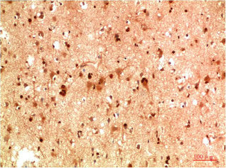 Immunohistochemical analysis of paraffin-embedded Human Brain Tissue using HSP40 Rabbit  pAb diluted at 1:200Rabbit anti-Human DNAJB1 Polyclonal Antibody