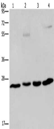 Gel: 10%SDS-PAGE, Lysate: 40 μg, Lane 1-4: A549 cells, human hepatocellular carcinoma tissue, mouse liver tissue, HT29 cells, Primary antibody: ETHE1 Antibody(ETHE1 Antibody) at dilution 1/400, Secondary antibody: Goat anti rabbit IgG at 1/8000 dilution, Exposure time: 1 minuteRabbit anti-Human ETHE1 Polyclonal Antibody