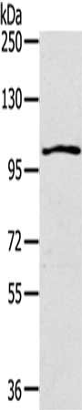 Gel: 6%SDS-PAGE, Lysate: 40 μg, Lane: K562 cells, Primary antibody: IL17RA Antibody(IL17RA Antibody) at dilution 1/200, Secondary antibody: Goat anti rabbit IgG at 1/8000 dilution, Exposure time: 1 minuteRabbit anti-Human IL17RA Polyclonal Antibody