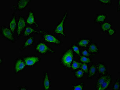 Immunofluorescent analysis of A549 cells using SPIN4 Antibody at dilution of 1:100 and Alexa Fluor 488-congugated AffiniPure Goat Anti-Rabbit IgG(H+L)Rabbit anti-Human SPIN4 Polyclonal Antibody