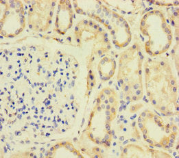 Immunohistochemistry of paraffin-embedded human kidney tissue using the antibody at dilution of 1:100Rabbit anti-Human SPIN4 Polyclonal Antibody