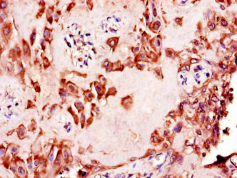 Immunohistochemistry of paraffin-embedded human placenta tissue using NAALADL2 Antibody at dilution of 1:100Rabbit anti-Human NAALADL2 Polyclonal Antibody