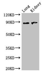 Western Blot  | Positive WB detected in: Mouse lung tissue, Mouse kidney tissue  | All lanes: NAALADL2 antibody at 3.5µg/ml  | Secondary  | Goat polyclonal to rabbit IgG at 1/50000 dilution  | Predicted band size: 89, 37 kDa  | Observed band size: 89 kDaRabbit anti-Human NAALADL2 Polyclonal Antibody