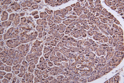 Immunohistochemistry of paraffin-embedded human Pancreatic tissue using MEST Antibody at dilution of 1:50