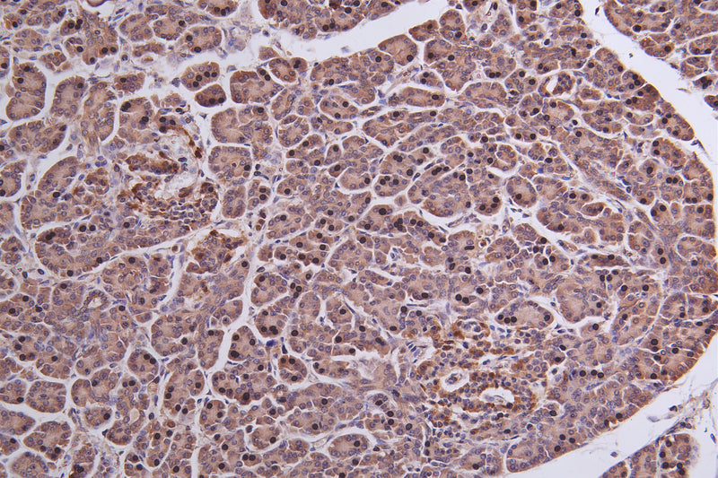 Immunohistochemistry of paraffin-embedded human Pancreatic tissue using MEST Antibody at dilution of 1:50