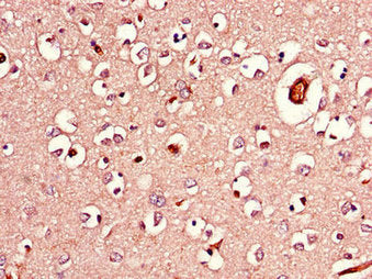 Immunohistochemistry of paraffin-embedded human brain tissue using AGK Antibody at dilution of 1:100Rabbit anti-Human AGK Polyclonal Antibody