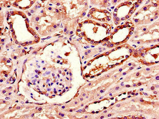 Immunohistochemistry of paraffin-embedded human kidney tissue using AGK Antibody at dilution of 1:100Rabbit anti-Human AGK Polyclonal Antibody
