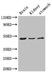 Western Blot | Positive WB detected in: Mouse brain tissue, Mouse kidney tissue, Mouse stomach tissue | All lanes: AGK antibody at 3μg/ml | Secondary | Goat polyclonal to rabbit IgG at 1/50000 dilution | Predicted band size: 48, 8 kDa | Observed band size: 48 kDaRabbit anti-Human AGK Polyclonal Antibody