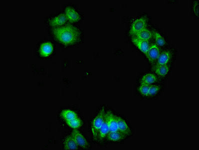 Immunofluorescent analysis of HepG2 cells using LACTB2 Antibody at dilution of 1:100 and Alexa Fluor 488-congugated AffiniPure Goat Anti-Rabbit IgG(H+L)