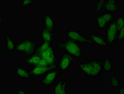 Immunofluorescent analysis of Hela cells using COBLL1 Antibody at dilution of 1:100 and Alexa Fluor 488-congugated AffiniPure Goat Anti-Rabbit IgG(H+L)Rabbit anti-Human COBLL1 Polyclonal Antibody