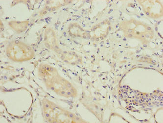 Immunohistochemistry of paraffin-embedded human kidney tissue using the antibody at dilution of 1:100Rabbit anti-Human COBLL1 Polyclonal Antibody