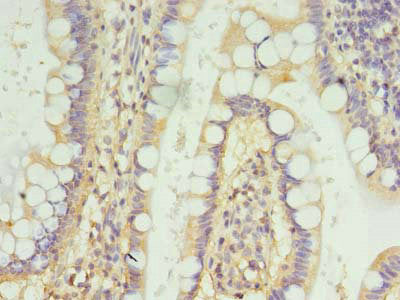 Immunohistochemistry of paraffin-embedded human small intestine tissue using FSCB Antibody at dilution of 1:100Rabbit anti-Human FSCB Polyclonal Antibody